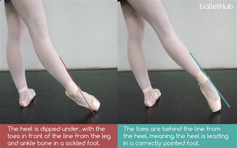 What is a Sickle Foot in Dance? And Its Multiple Facets Explored